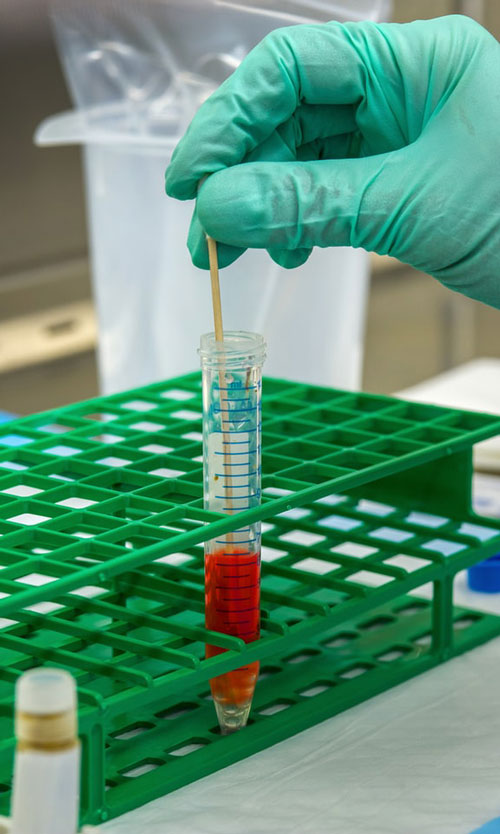 immune-sys-image2 es